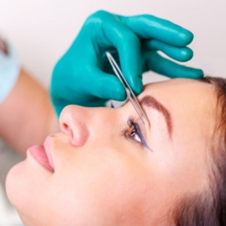 goz-kapagi-estetigi-7