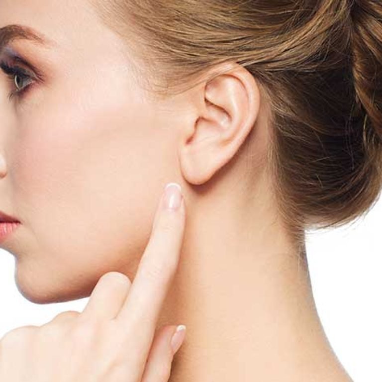 kepce-kulak-estetigi-otoplasti-02